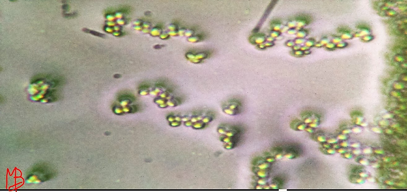 saccaromycaes cerevisiae (? )
